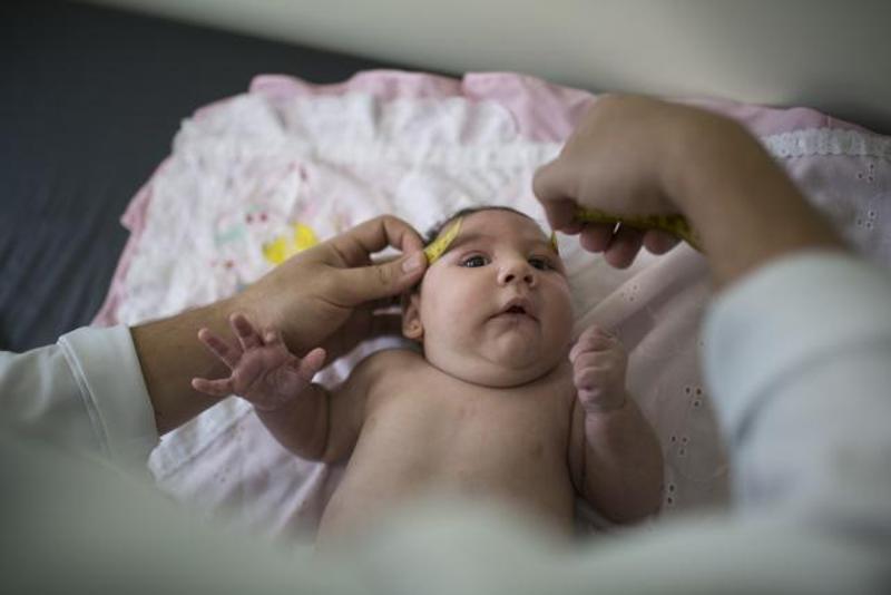 brazil-zika-birth-defects_b887e1f6-b446-11e5-9860-1d91036943d1