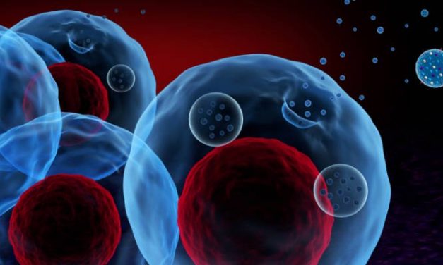 Un hôpital israélien est le premier au Moyen-Orient à utiliser un test de dépistage du cancer révolutionnaire