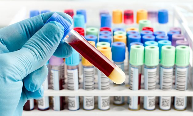COVID-19: Israël développe des tests sérologiques, plus précis pour les diagnostiques